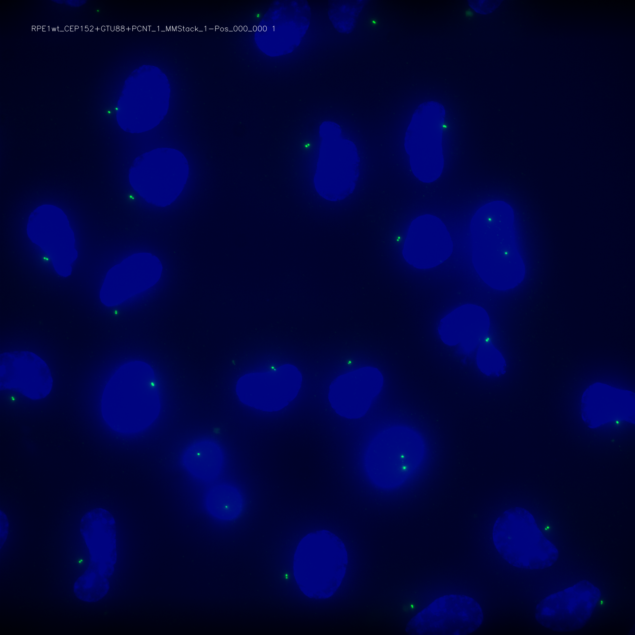 _images/RPE1wt_CEP152%2BGTU88%2BPCNT_1_MMStack_1-Pos_000_000_max_C1.png
